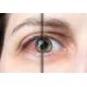 Clear Eyes Gotitas
